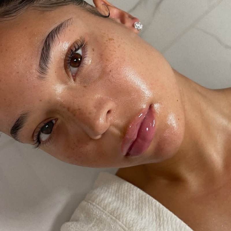 how to get clear skin overnight