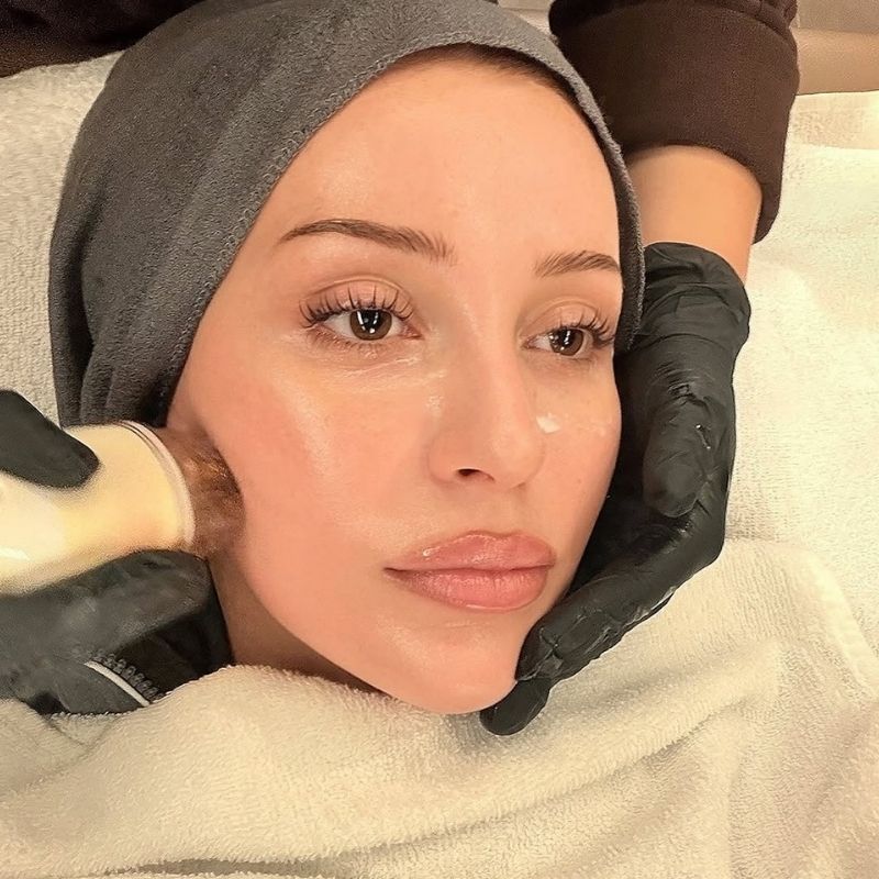 how to get rid of eye bags in minutes
