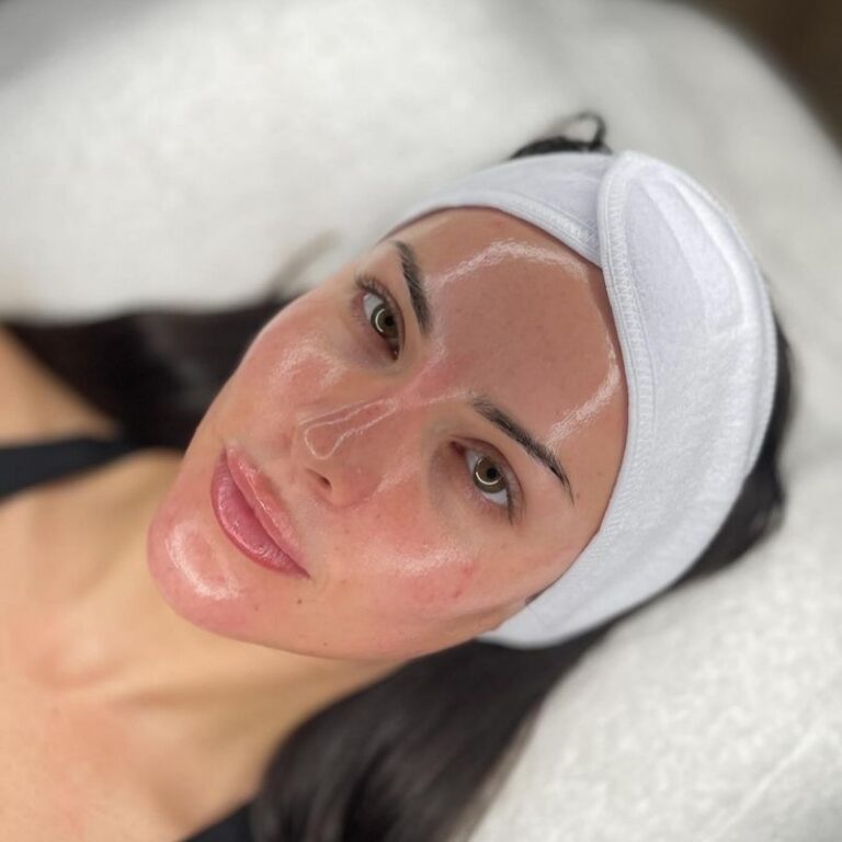how to get rid of fine lines under eyes