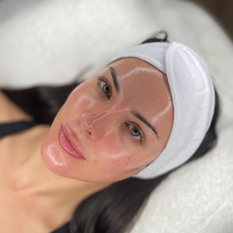 how to get rid of fine lines under eyes